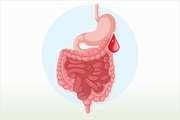 In-hospital mortality in patients with lower gastrointestinal bleeding: development and validation of a prediction score