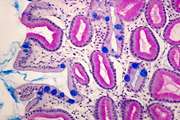 Prevalence and risk factors of gastric intestinal metaplasia: an International Classification of Diseases, 10th Revision-based study in an Iranian population