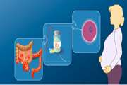  Fertility and Pregnancy complications in Women with Inflammatory Bowel Disease