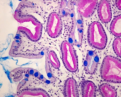 Prevalence and risk factors of gastric intestinal metaplasia: an International Classification of Diseases, 10th Revision-based study in an Iranian population